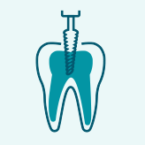 Endodonzia in microscopia