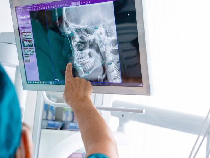 Chirurgia implantare guidata al computer