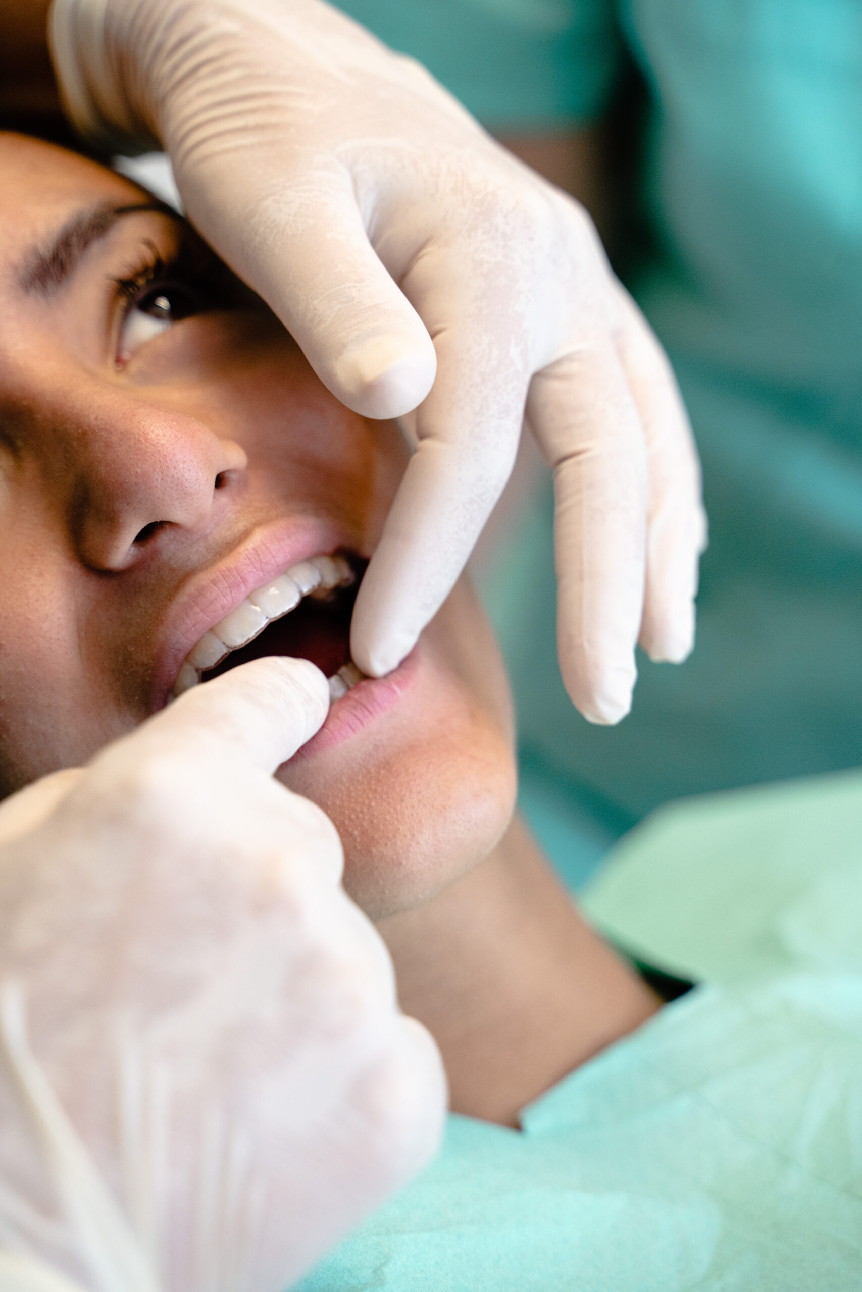 Alternativa alle faccette dentali